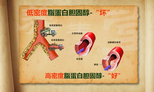 BTV养生堂远离高血脂的解决之道-别有病 Byb