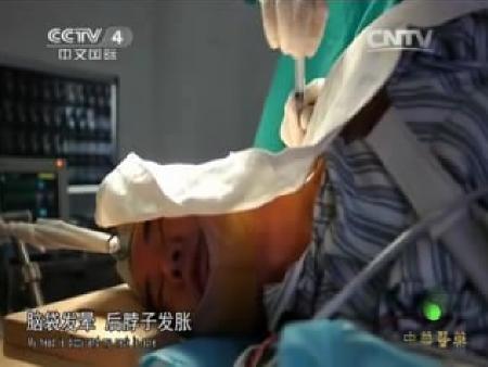 中华医药小针刀治疗颈椎病