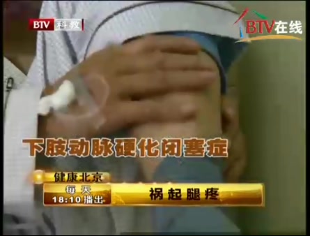 健康北京祸气腿痛-下肢动脉硬化闭塞