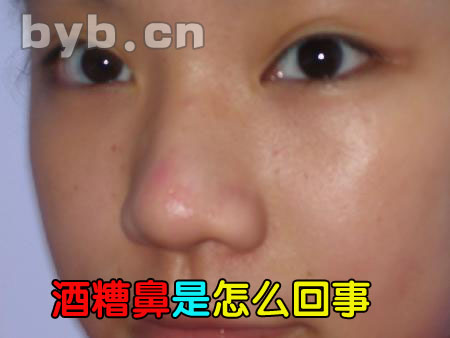 byb.cn byb.cn