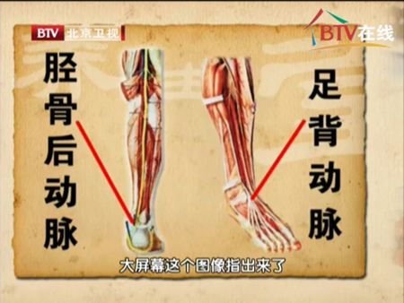 如果下肢脉搏出现异常,不仅仅要测左右的血压差,还要与上肢的血压