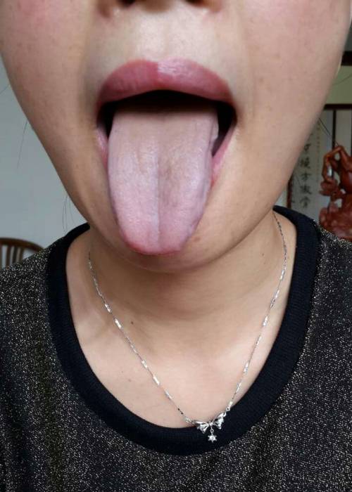 8 10:53               经历了这么多反反复复的微信咨询,d女士的舌苔
