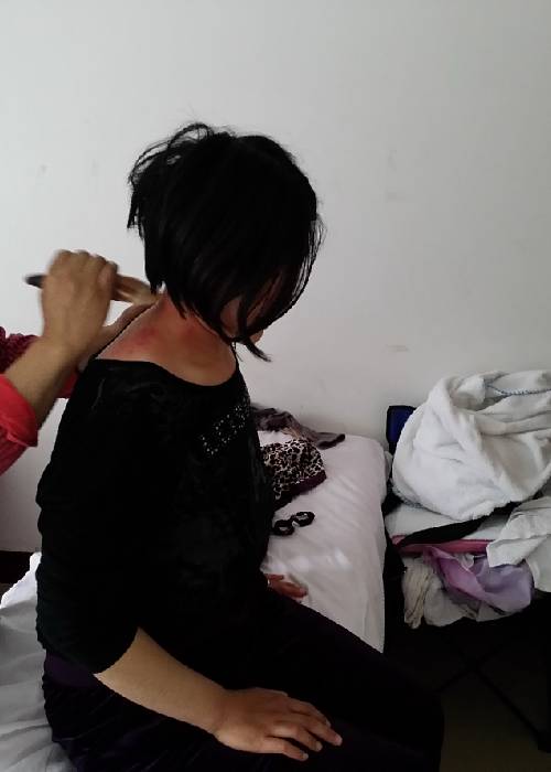 昆叔在给f脖子刮痧