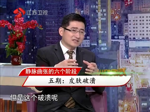 在第二集中,张强医生告诉我们,静脉曲张是怎么得的?