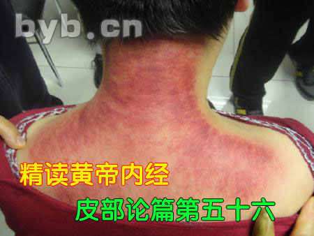 byb.cn 黄帝内经皮部论篇第五十六