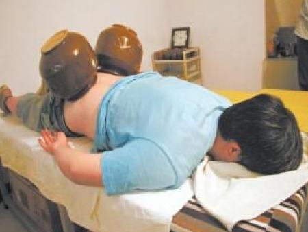 byb.cn 酸菜坛子火罐