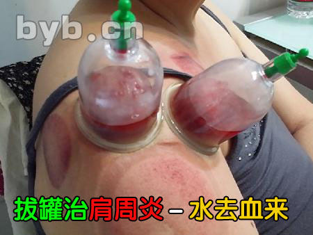 byb.cn byb.cn