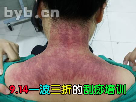 byb.cn 刮痧培训