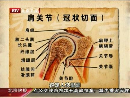 肩关节冠状切面图片